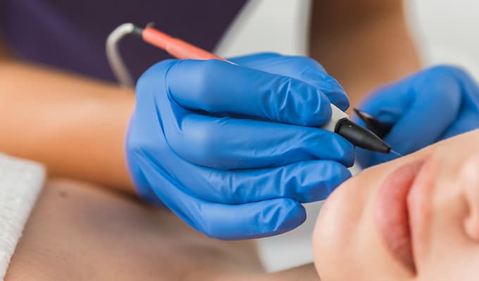 Descubre la depilación eléctrica de los tratamientos de belleza del centro de estética mari nati
